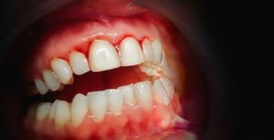 Richiedi il tuo preventivo gratuito