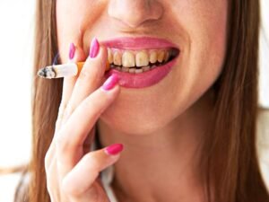 Fumo e impianti dentali